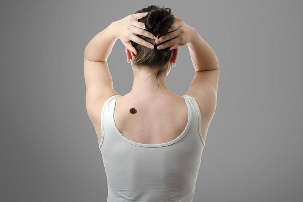 Early Warning Signs of Various Skin Cancer Types