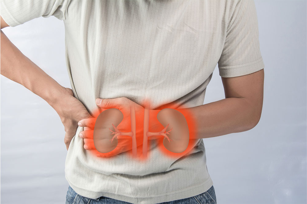 7 Symptoms of Renal Cancer