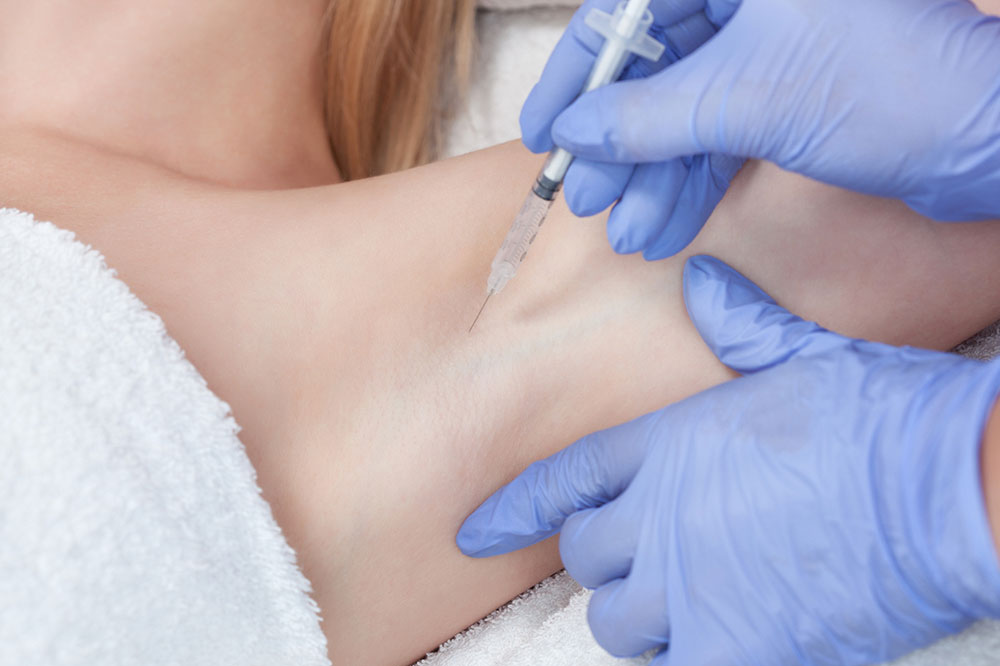 8 Ways in Which Hyperhidrosis can be Treated